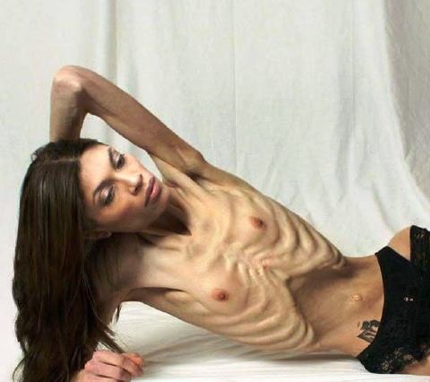 Semi anorexic naked women